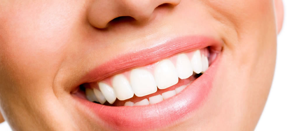 予防歯科のホワイトニング効果