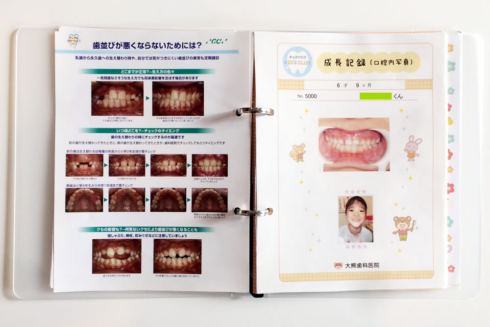 お口の成長アルバム